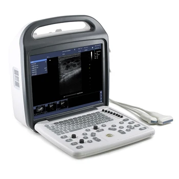 Блок развертки ультразвука ноутбука Допплера цифров больничного оборудования утверждения ИСО КЭ полный ультразвуковой диагностический